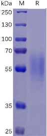 Human IL17RA Protein, His Tag