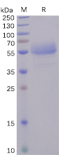 Human ICOS Protein, hFc tag