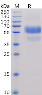 Human CD70 Protein, hFc-His Tag