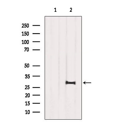 SIRT3 Antibody