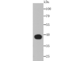 DSG1 Rabbit mAb