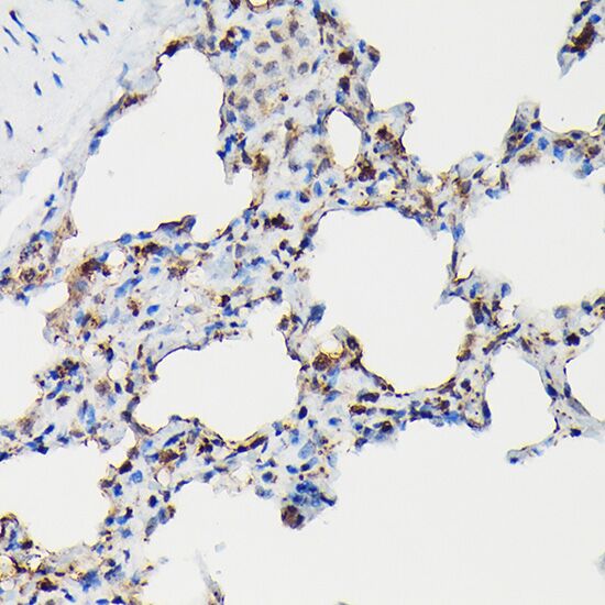 SFTPA1 antibody