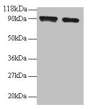 Diamine acetyltransferase 1 Polyclonal Antibody