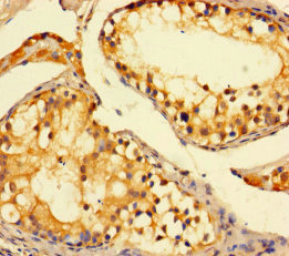 Diamine acetyltransferase 1 Polyclonal Antibody