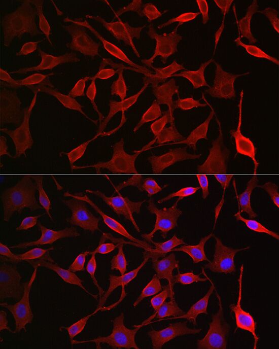 SLC16A1 antibody