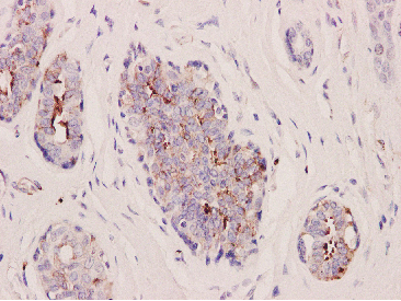 Integrin beta 3 Rabbit mAb