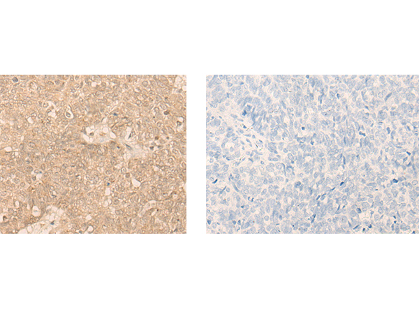 CCNE1 Antibody