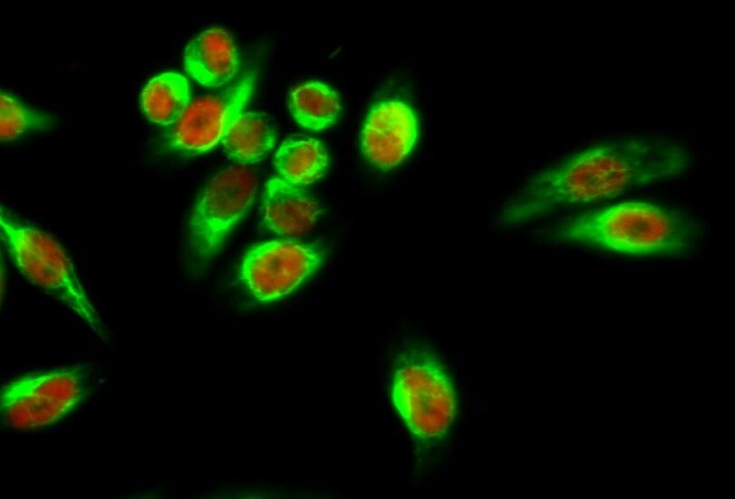 Amyloid-β Polyclonal Antibody