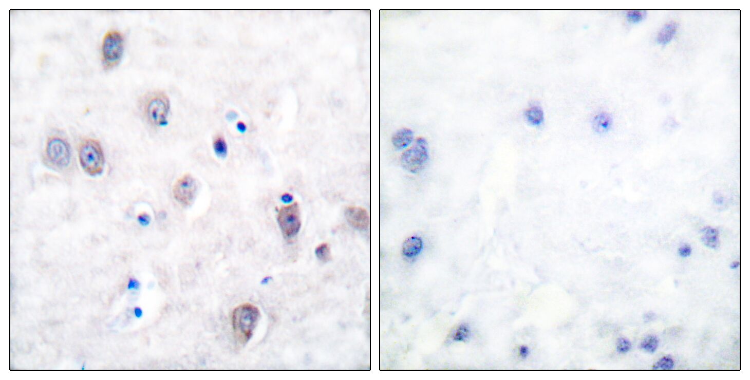 Amyloid-β Polyclonal Antibody