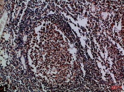 IL-17D Polyclonal Antibody