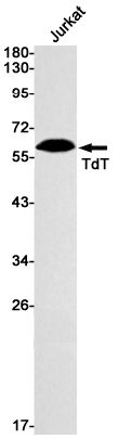 DNA Nucleotidylexotransferase Rabbit mAb