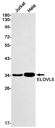 ELOVL5 Rabbit mAb