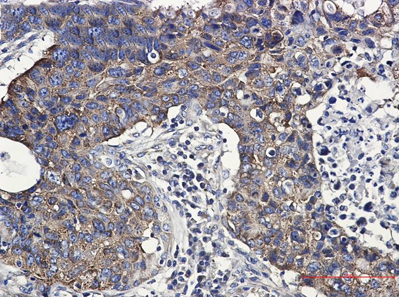 FMRP Rabbit mAb