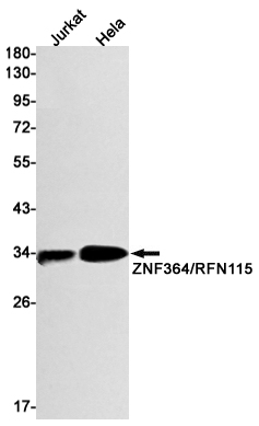 ZNF364 Rabbit mAb