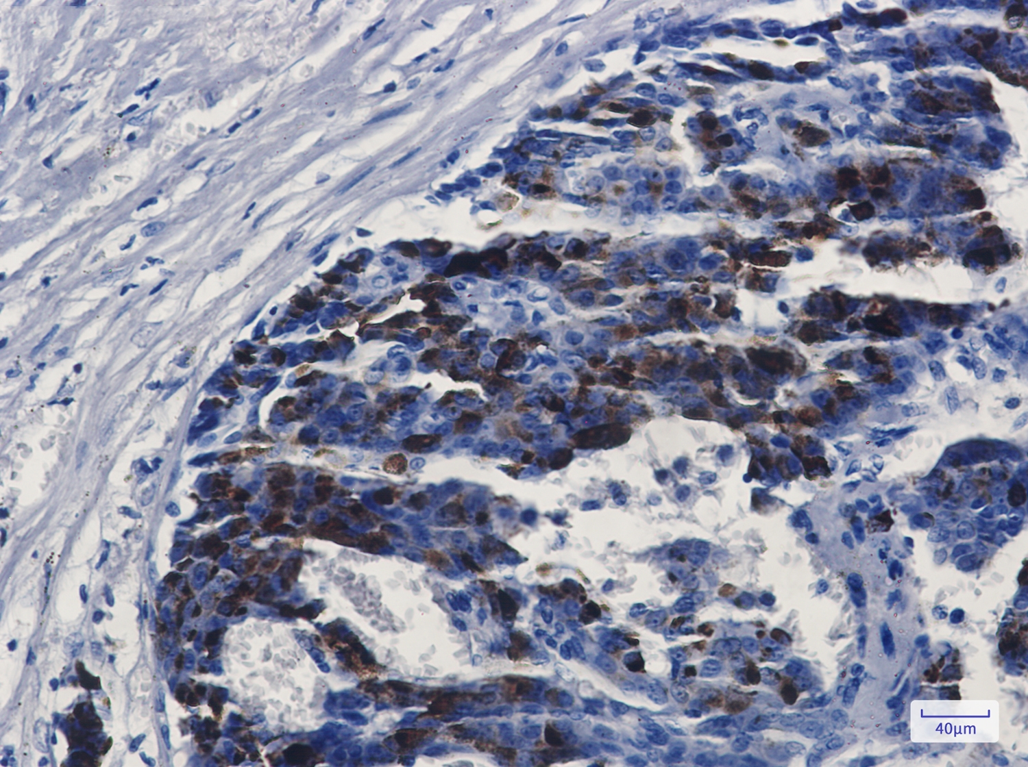 MMP14 Rabbit mAb