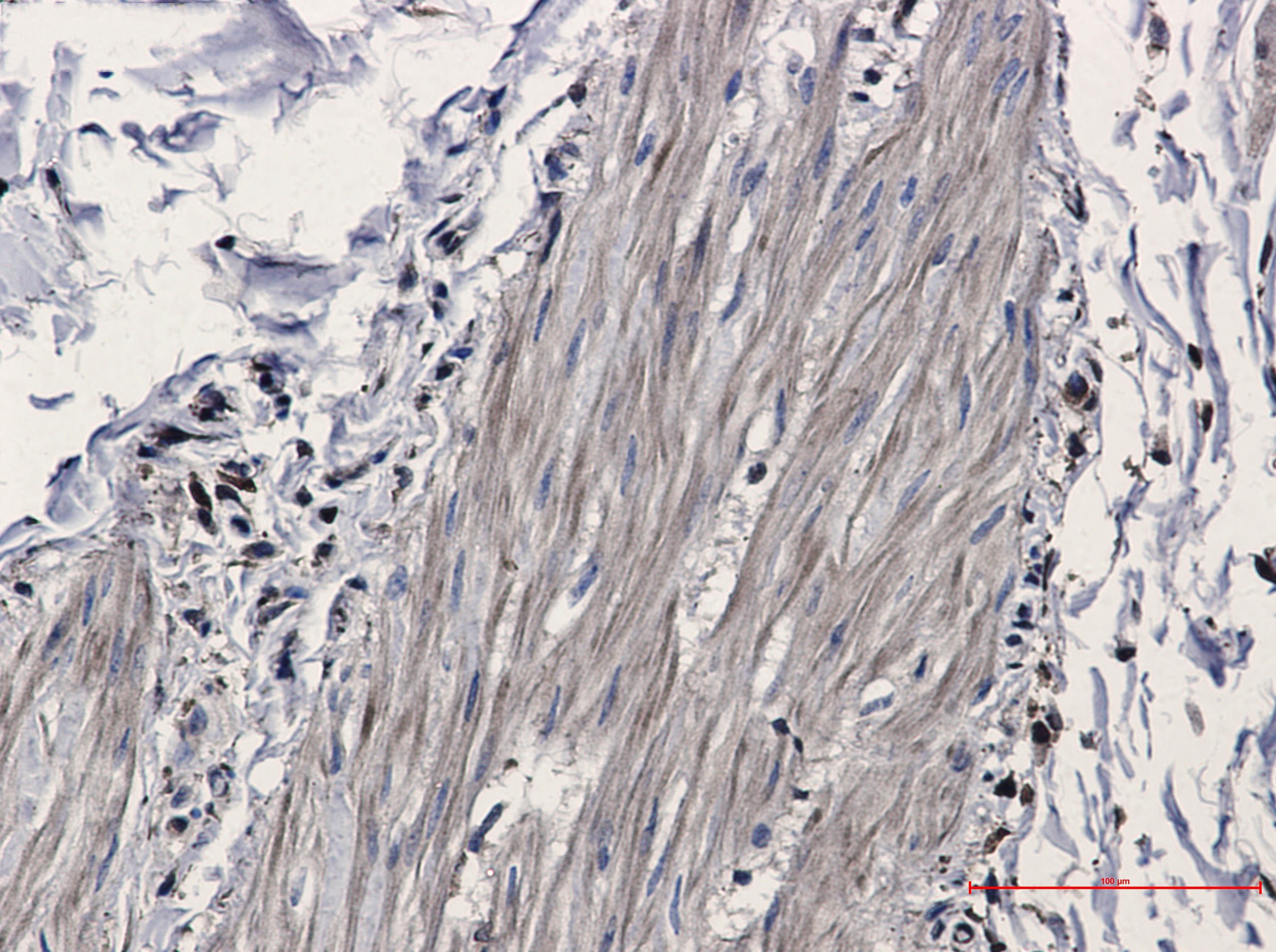 IDH1 Rabbit mAb