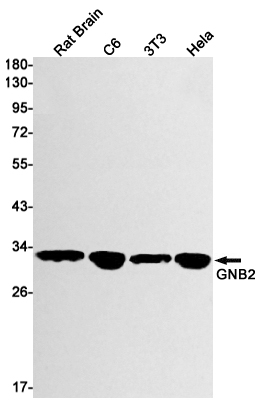 GNB2 Rabbit mAb