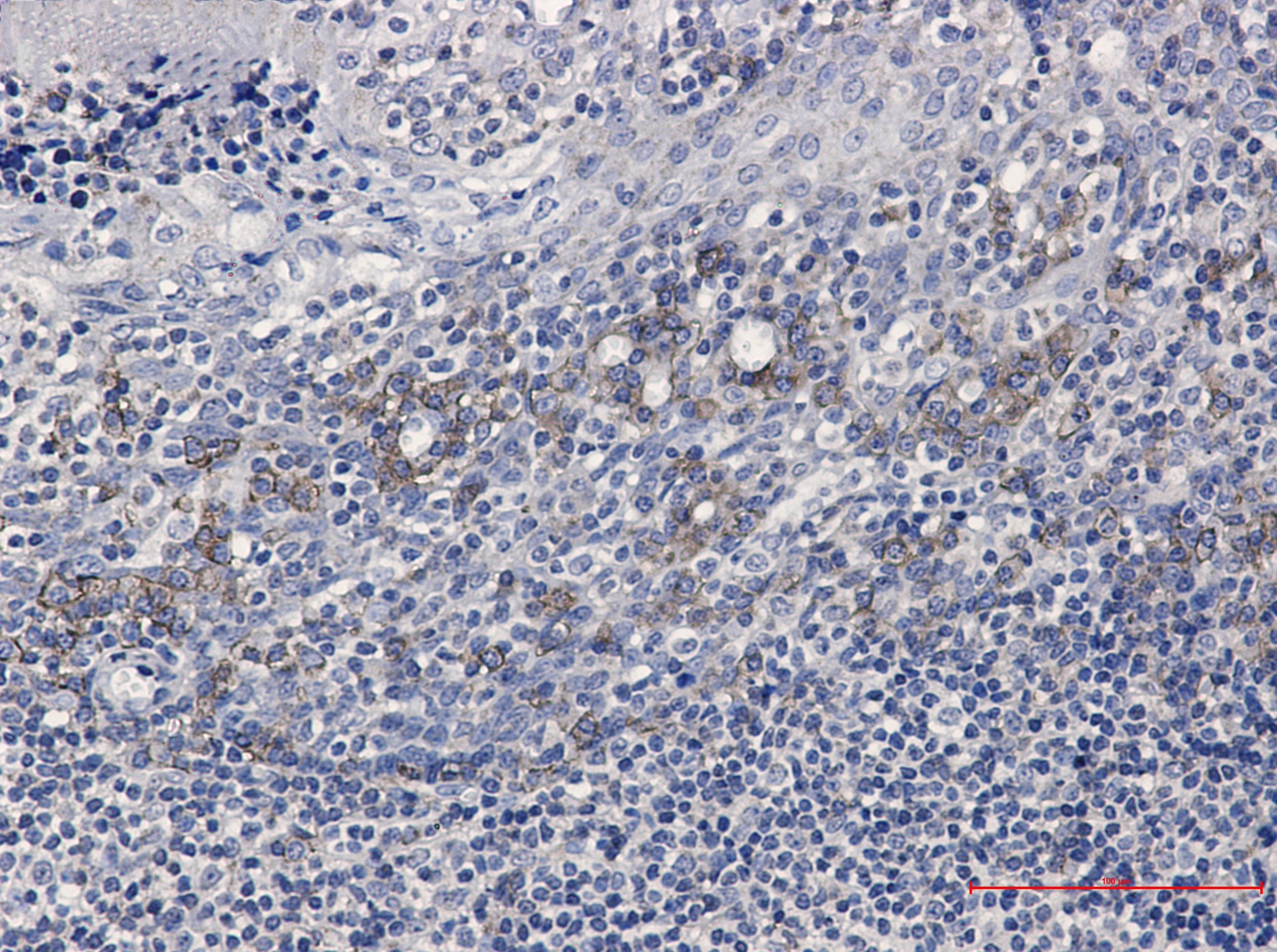 CD32B Rabbit mAb