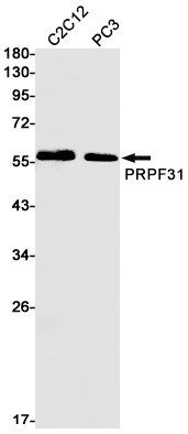 PRPF31 Rabbit mAb