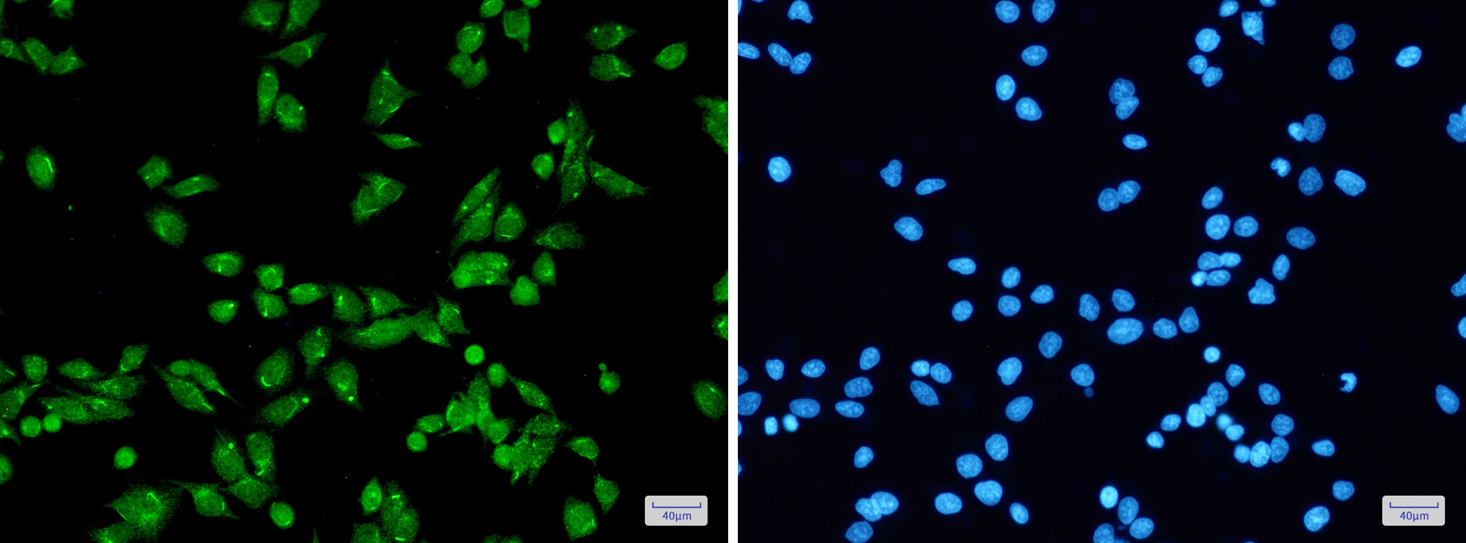 PRPF31 Rabbit mAb