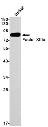 Factor XIIIa Rabbit mAb