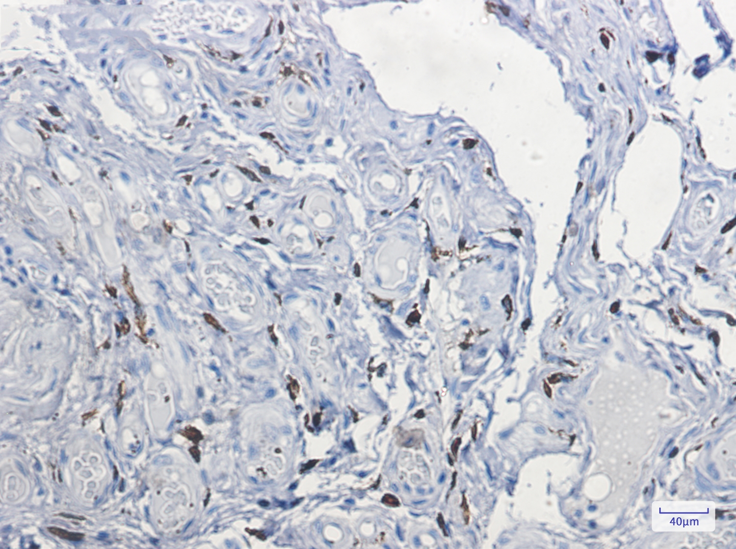 Factor XIIIa Rabbit mAb