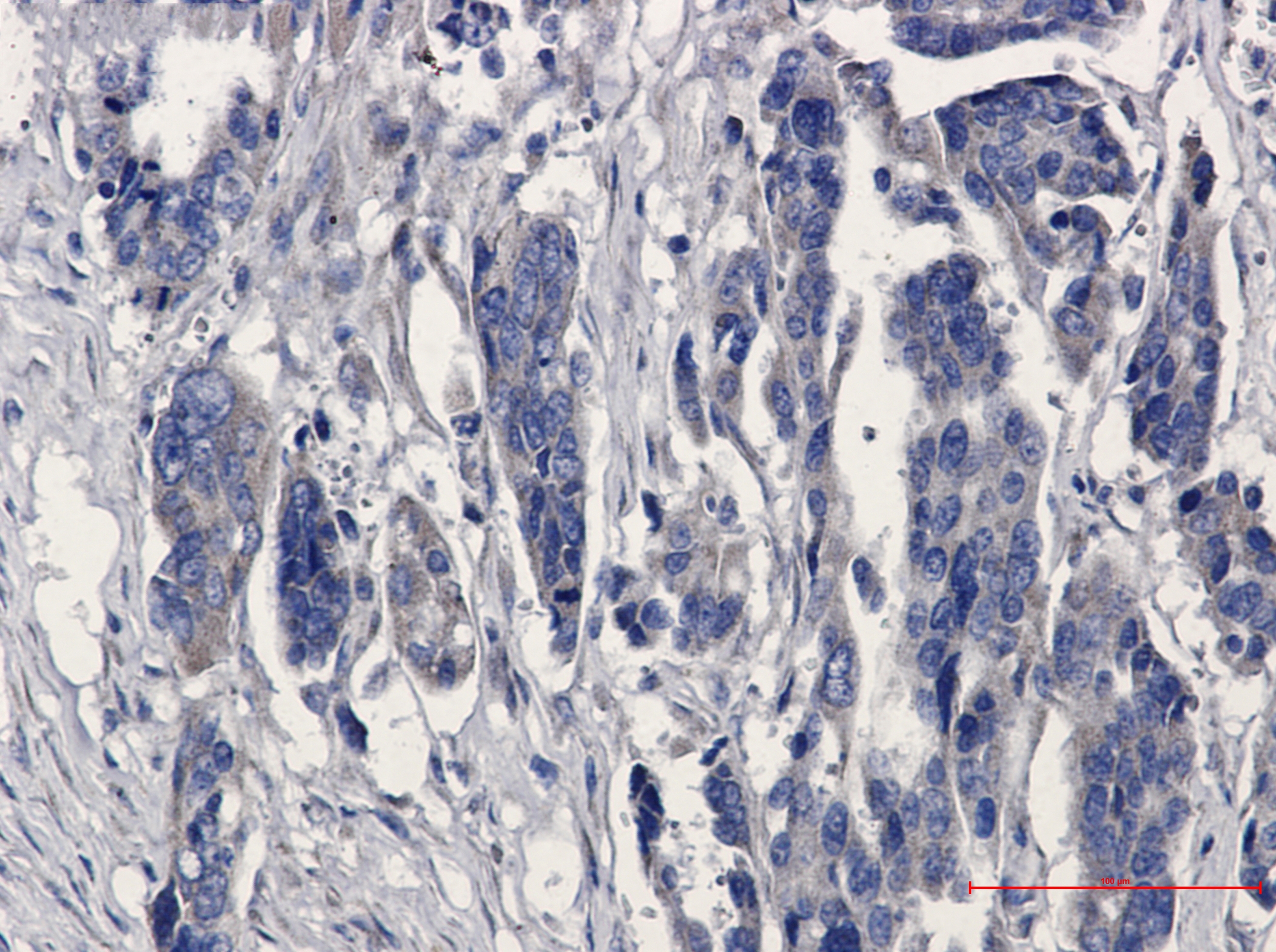 MGST1 Rabbit mAb