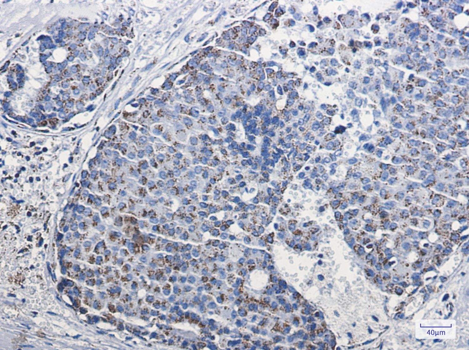 mtTFA Rabbit mAb