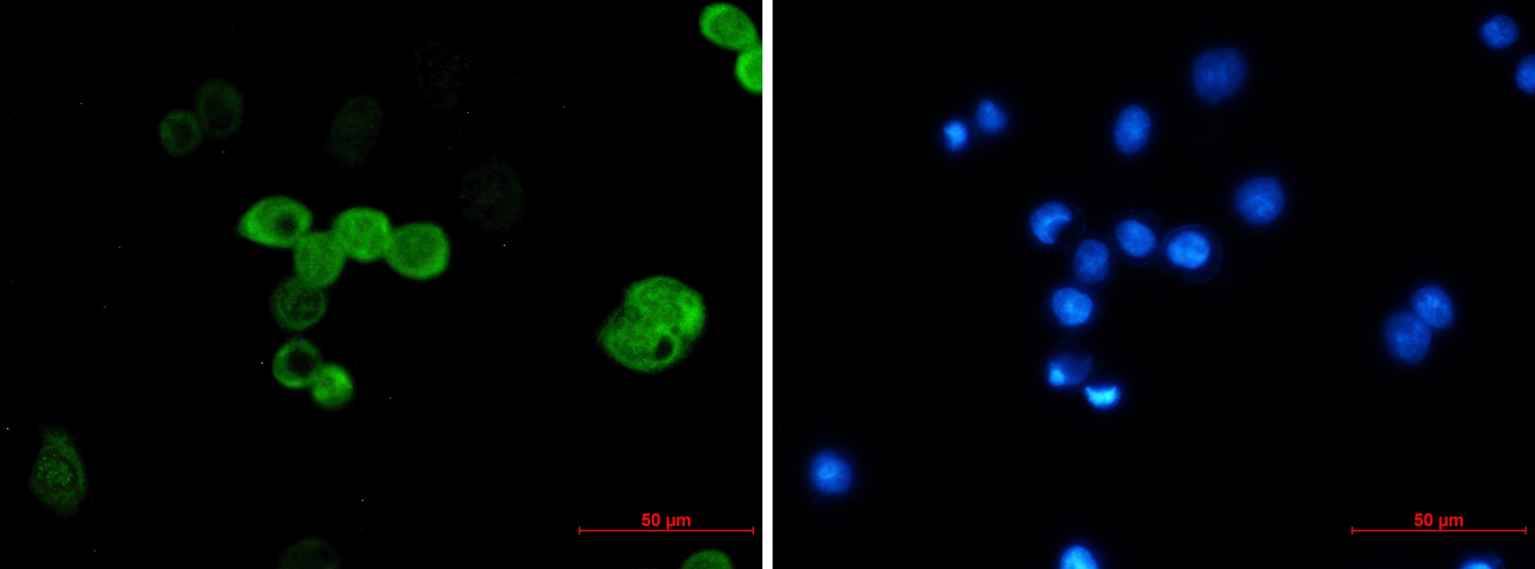 CRABP2 Rabbit mAb