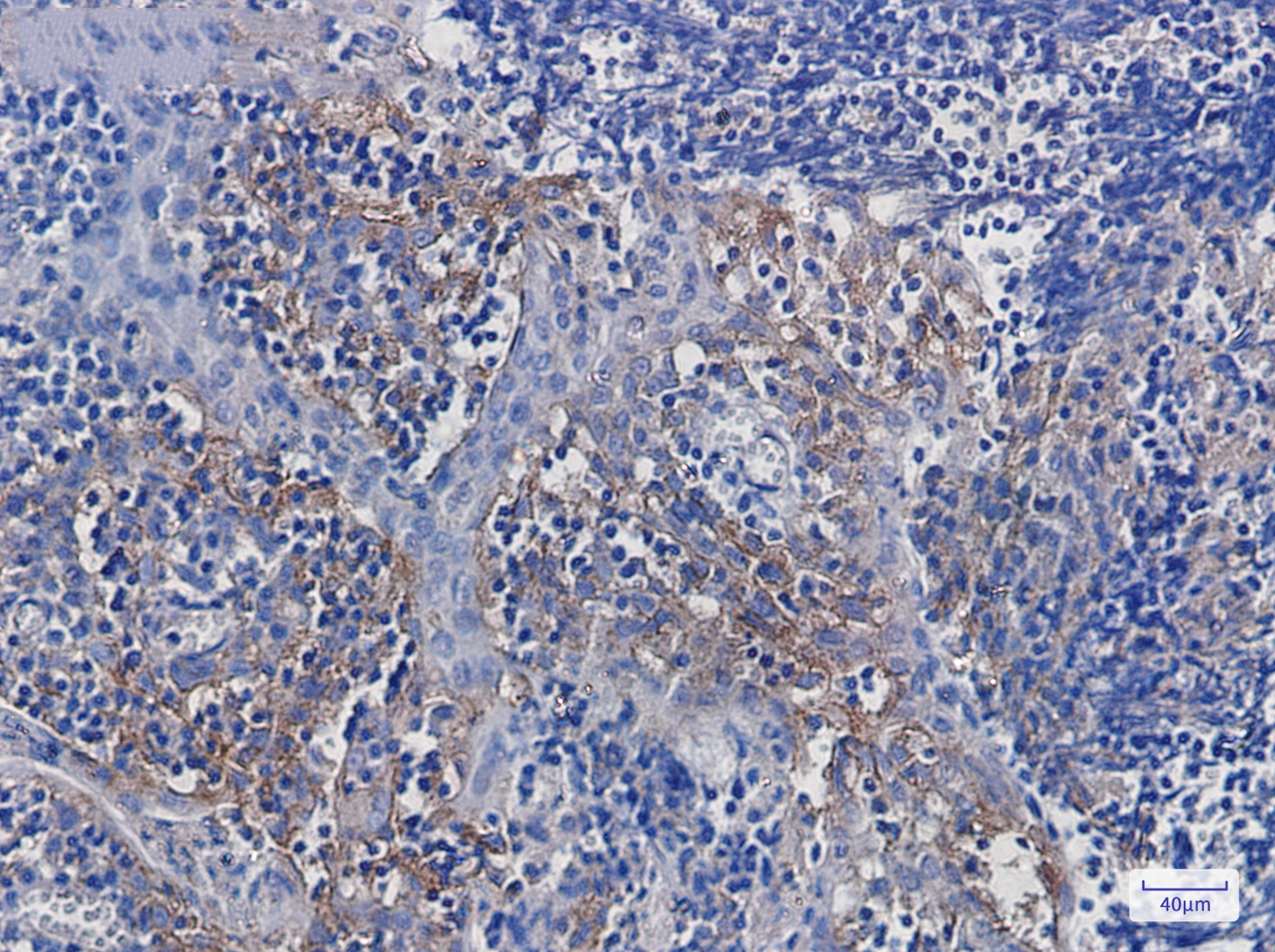 Integrin alpha V Rabbit mAb