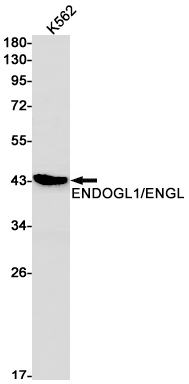 ENDOGL1 Rabbit mAb