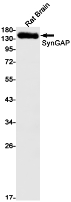 SynGAP Rabbit mAb