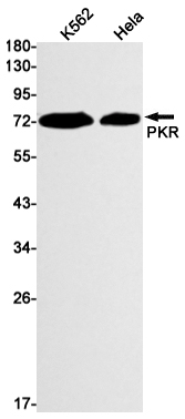 PKR Rabbit mAb