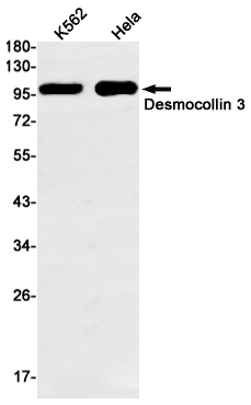 Desmocollin 3 Rabbit mAb