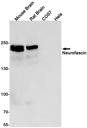 Neurofascin Rabbit mAb