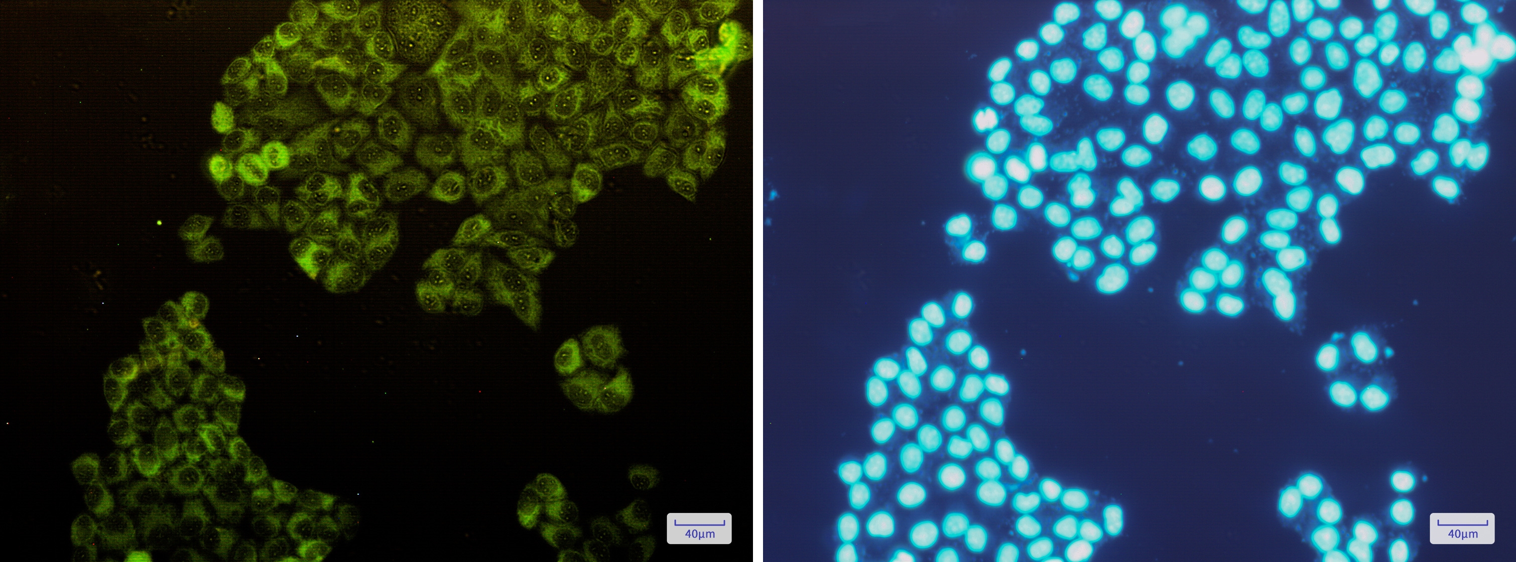 Fructose 6 Phosphate Kinase Rabbit mAb