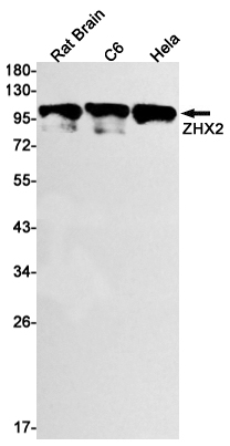 ZHX2 Rabbit mAb