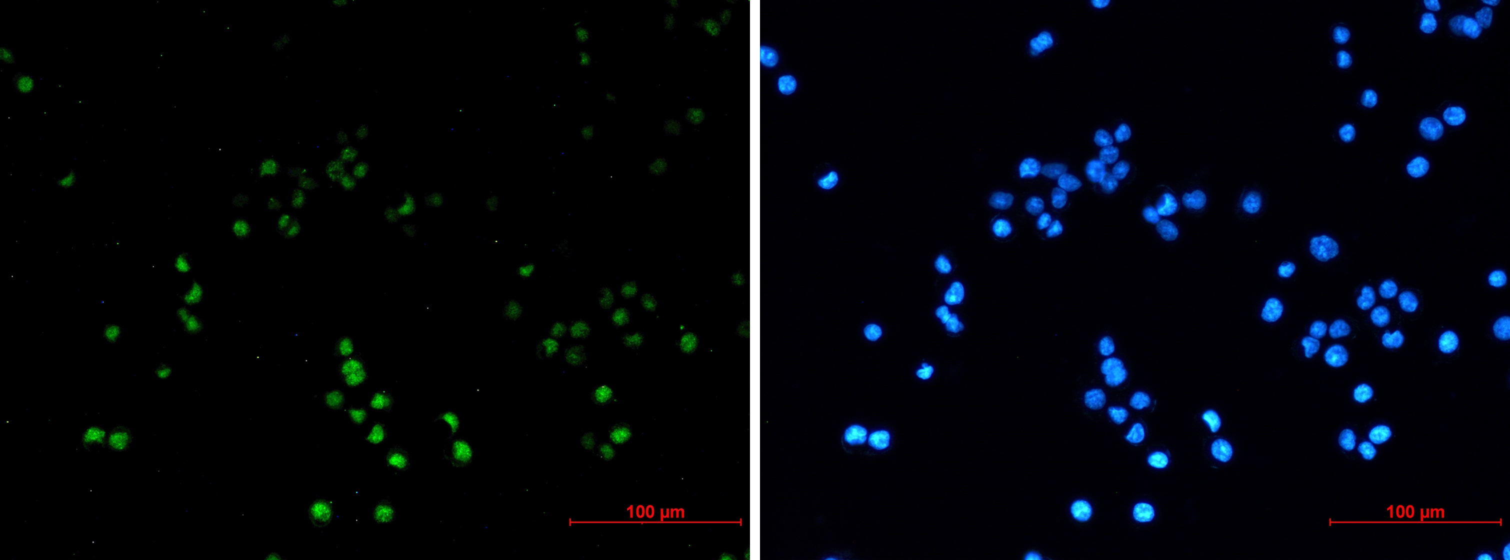 ZHX2 Rabbit mAb