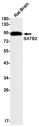 SATB2 Rabbit mAb