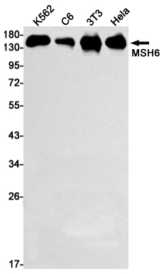 MSH6 Rabbit mAb