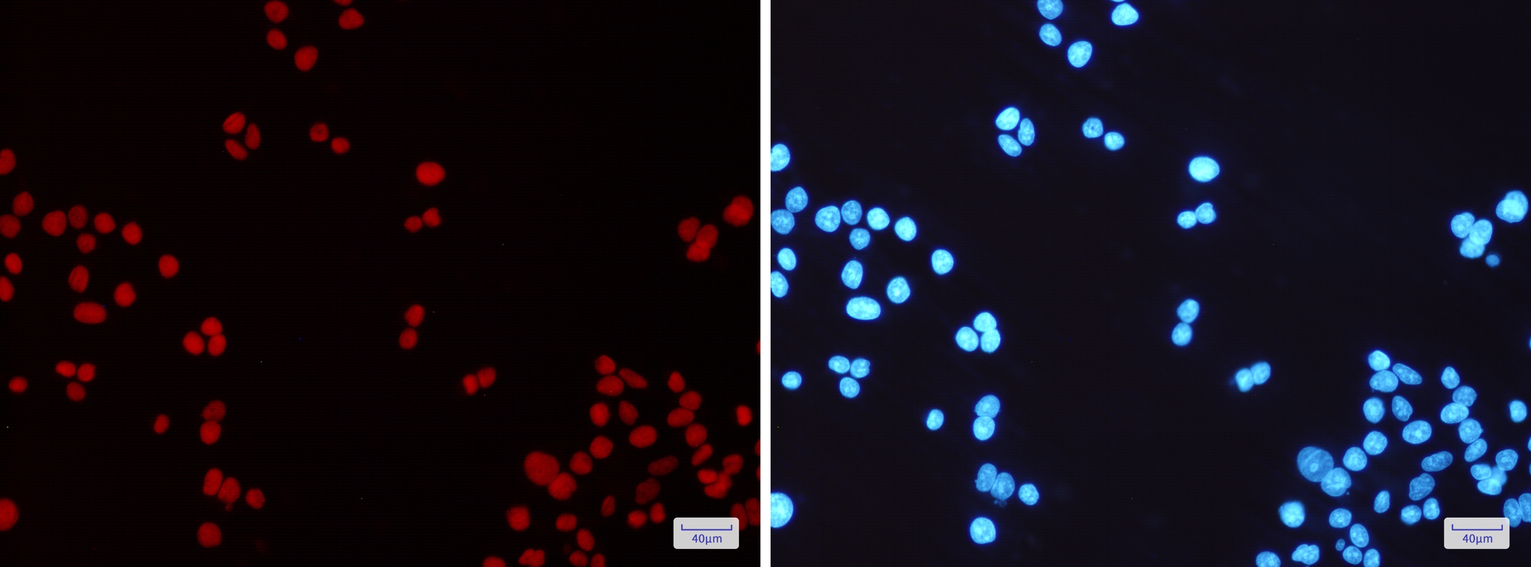 MSH6 Rabbit mAb