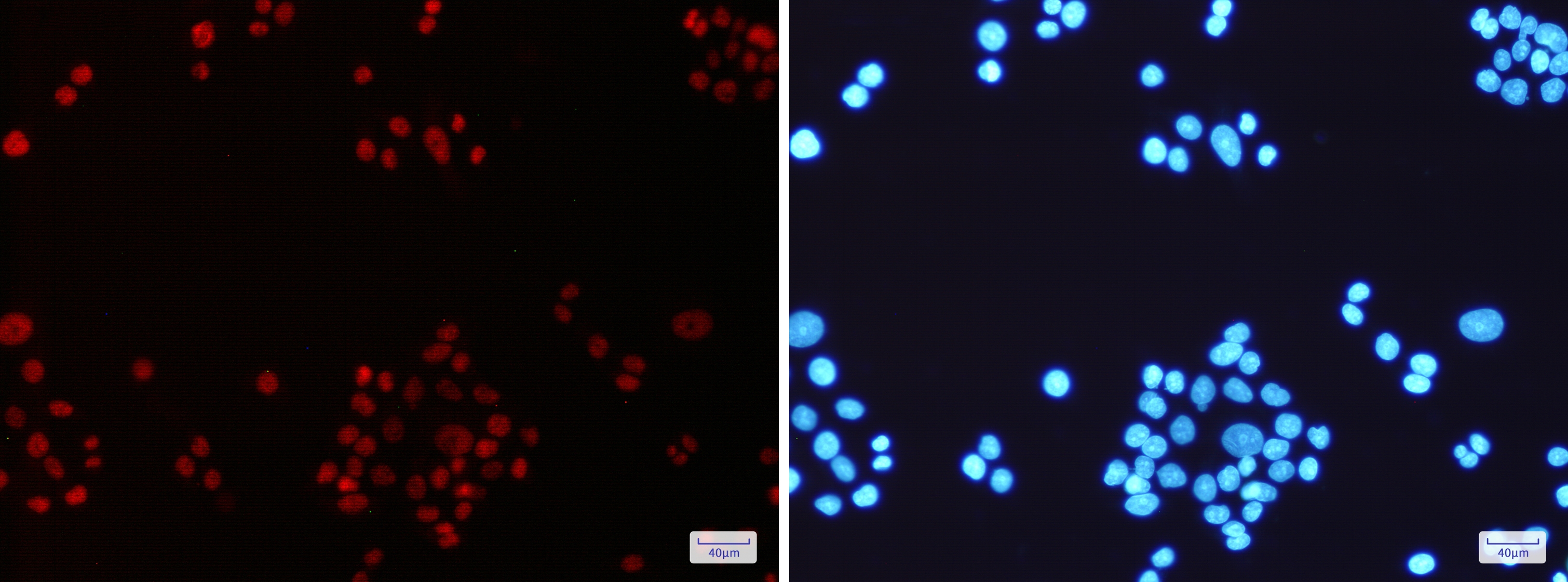 MLH1 Rabbit mAb