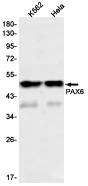 PAX6 Rabbit mAb