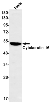 Cytokeratin 16 Rabbit mAb