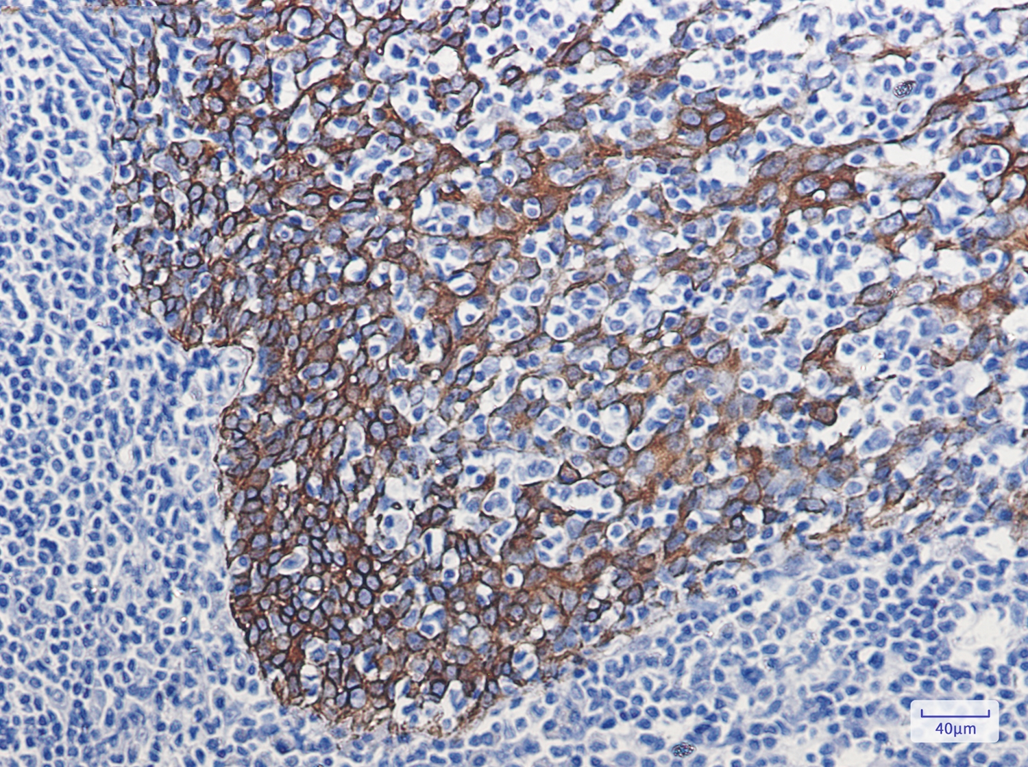 Cytokeratin 16 Rabbit mAb