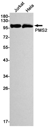 PMS2 Rabbit mAb