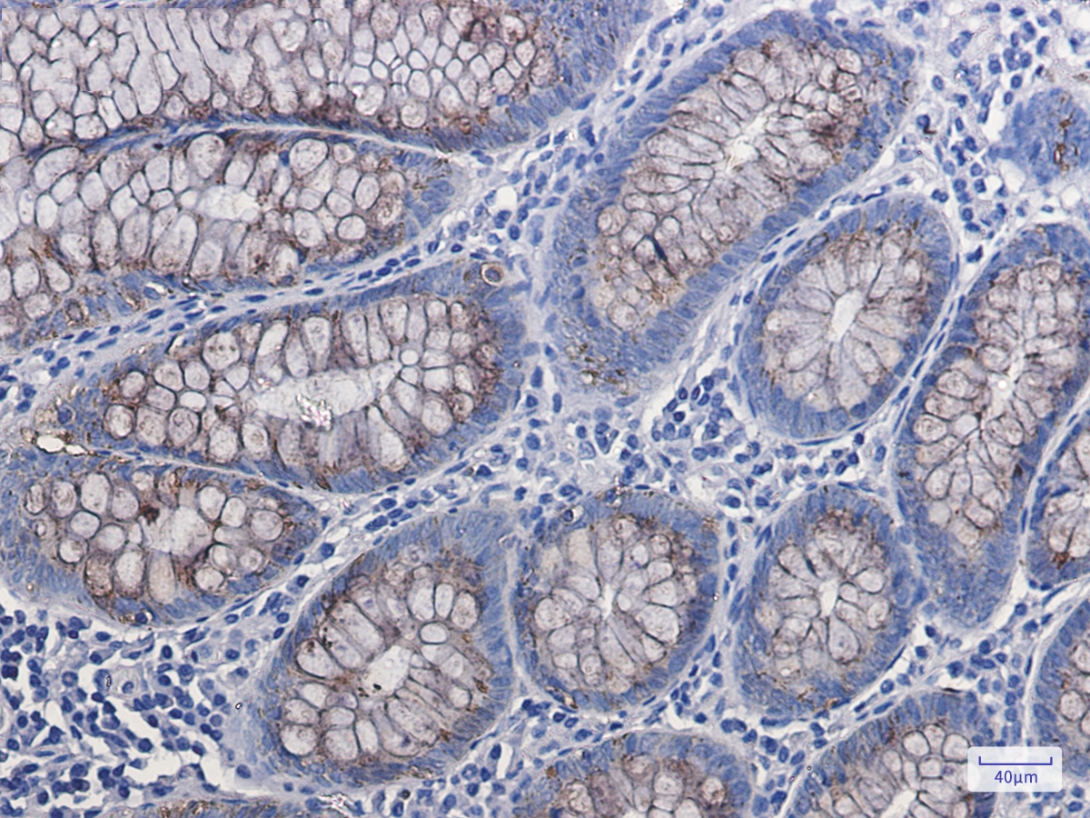 Anterior Gradient 2 Rabbit mAb