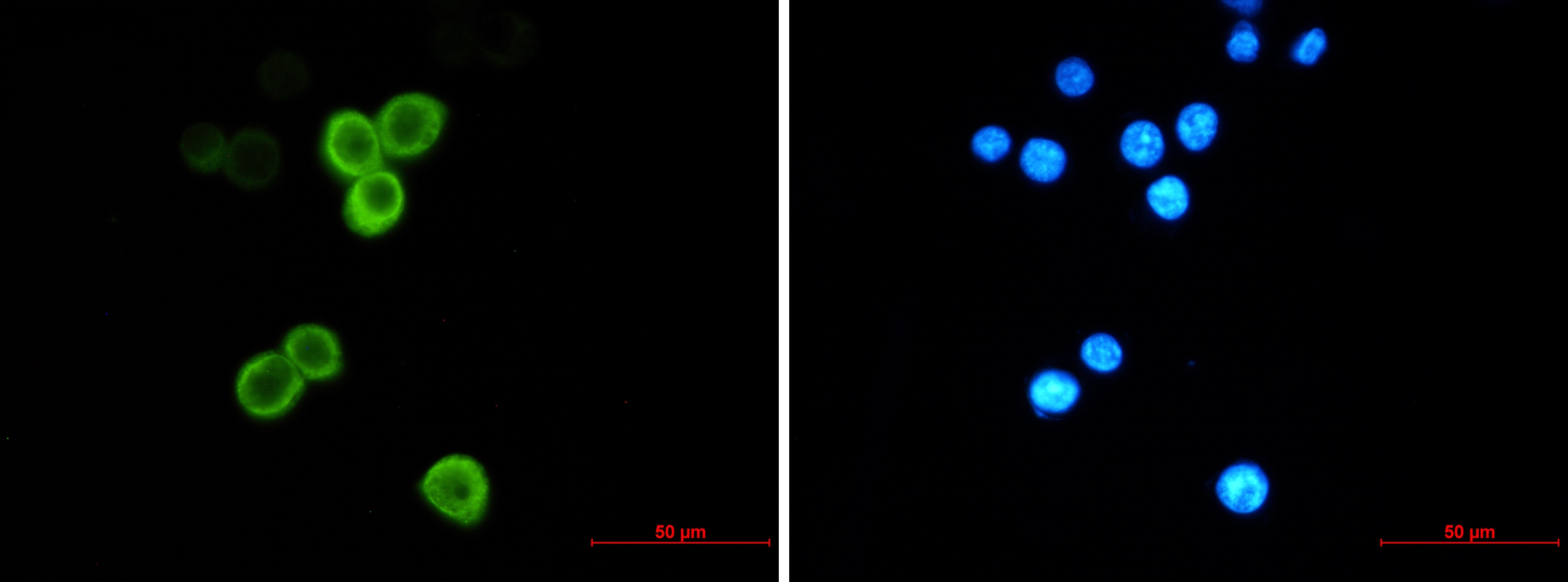 Anterior Gradient 2 Rabbit mAb