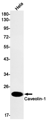 Caveolin 1 Rabbit mAb