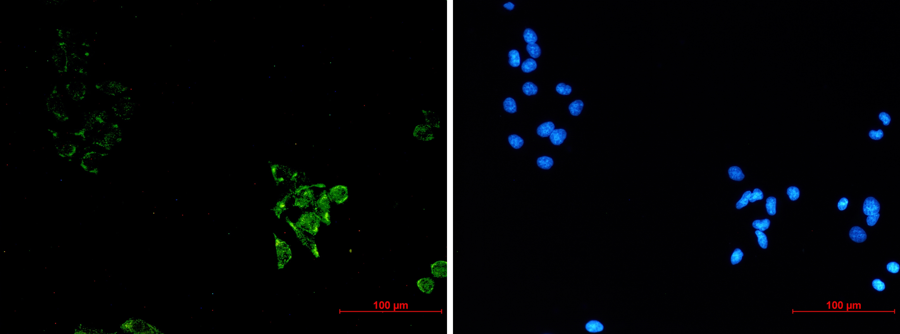 Caveolin 1 Rabbit mAb